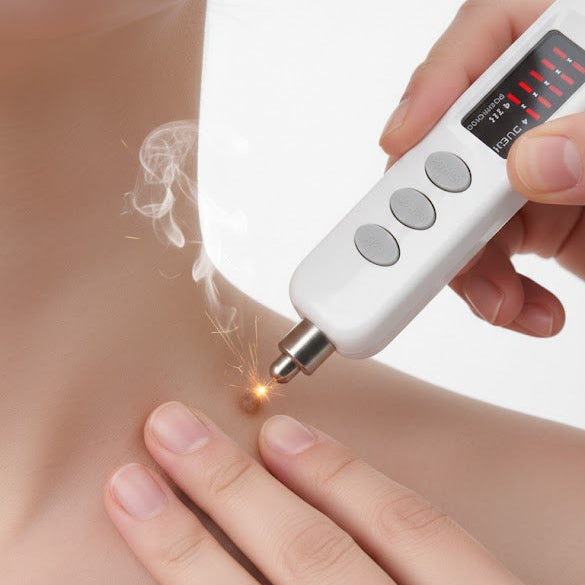 OEX PLUMA DE CARBON IONIZADA + REGALIA DE PARCHES CONTRA VERRUGAS Y CABEZAS DE VENA