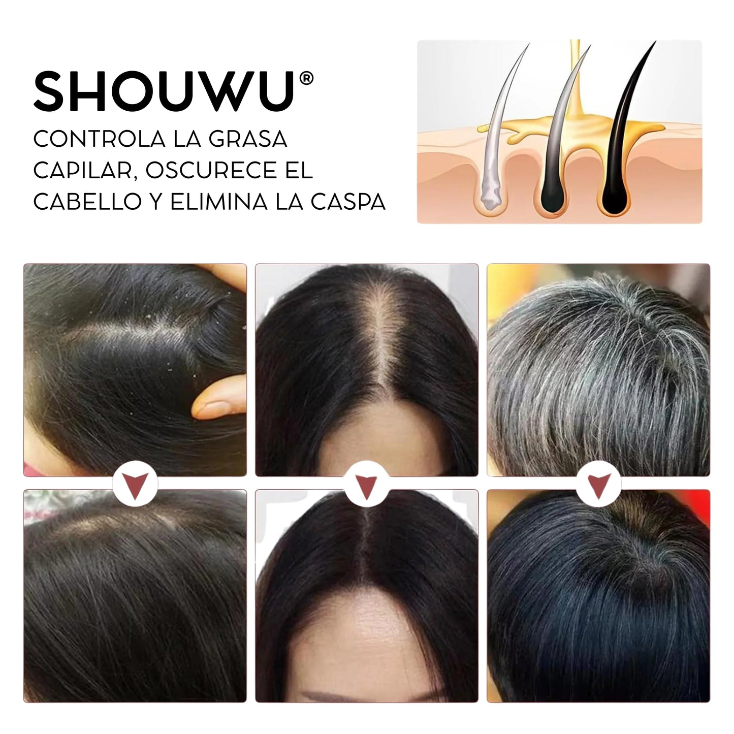3x1 Tratamiento de polygonum para el cabello